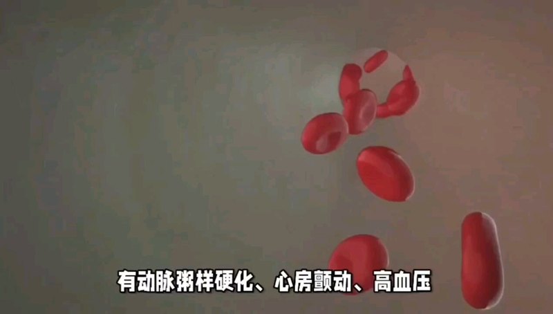 脑中风的多种原因