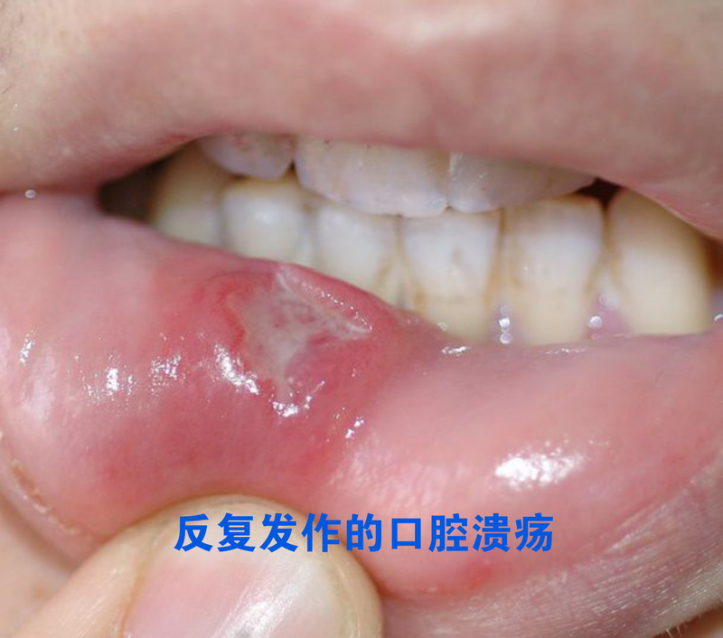 圖文圖片