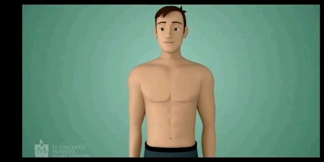 冠脉造影是如何做的