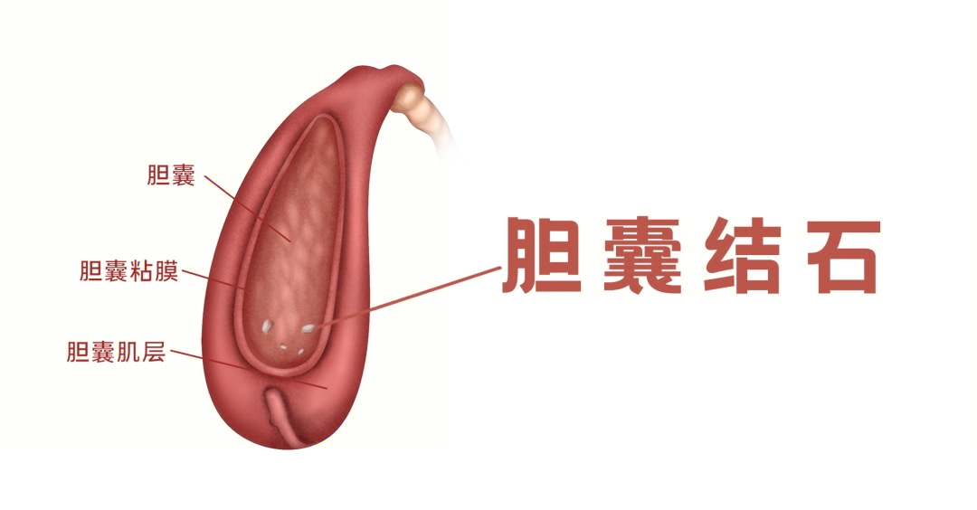 圖文圖片