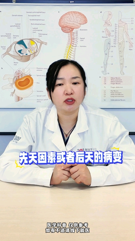 脊髓拴系综合征两个常见误区，看看你中招了吗？＃脊髓拴
