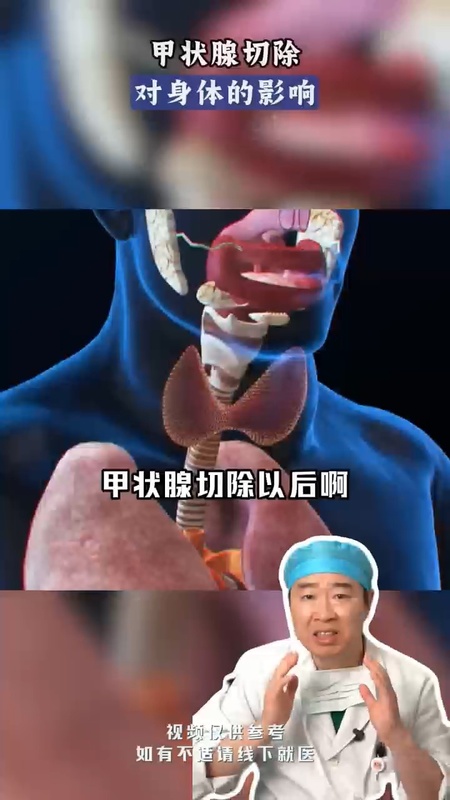甲状腺切除对身体有什么影响？
