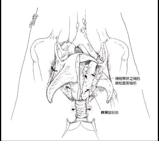 視頻封面