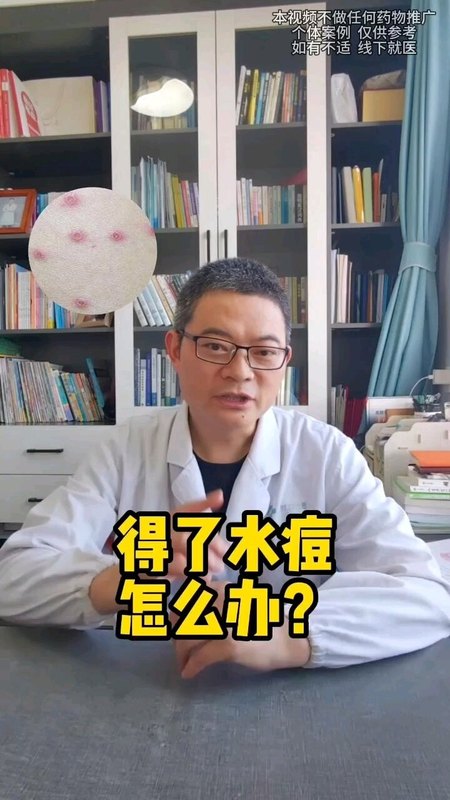 得了水痘怎么办