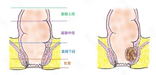 圖文圖片