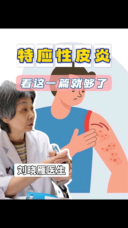 特应性皮炎-看这一篇就够了