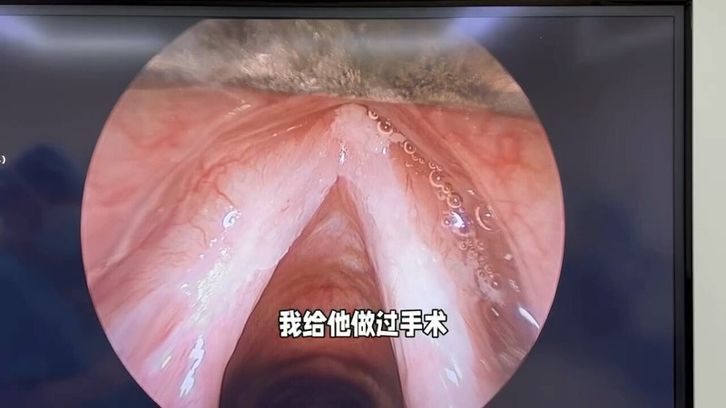 視頻封面
