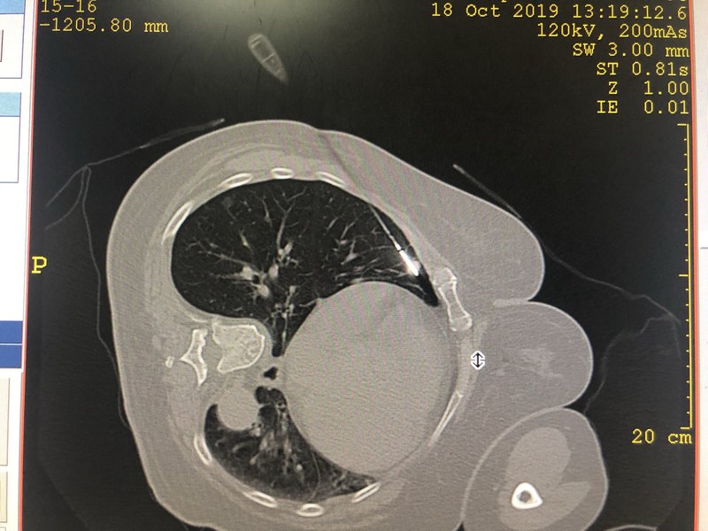 北京大学肿瘤医院预约门诊穿刺预约-北京大学肿瘤医院预约门诊穿刺预约怎么取消 
