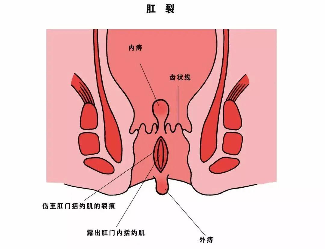 圖文圖片