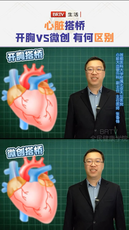 心脏搭桥，微创不开胸搭桥和传统开胸搭桥有什么不同呢？北京广播电视台全民健康学院栏目有答案。