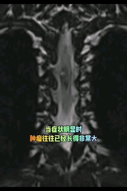 視頻封面