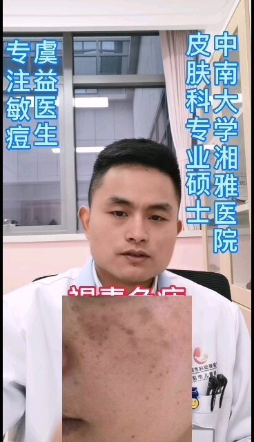 視頻封面