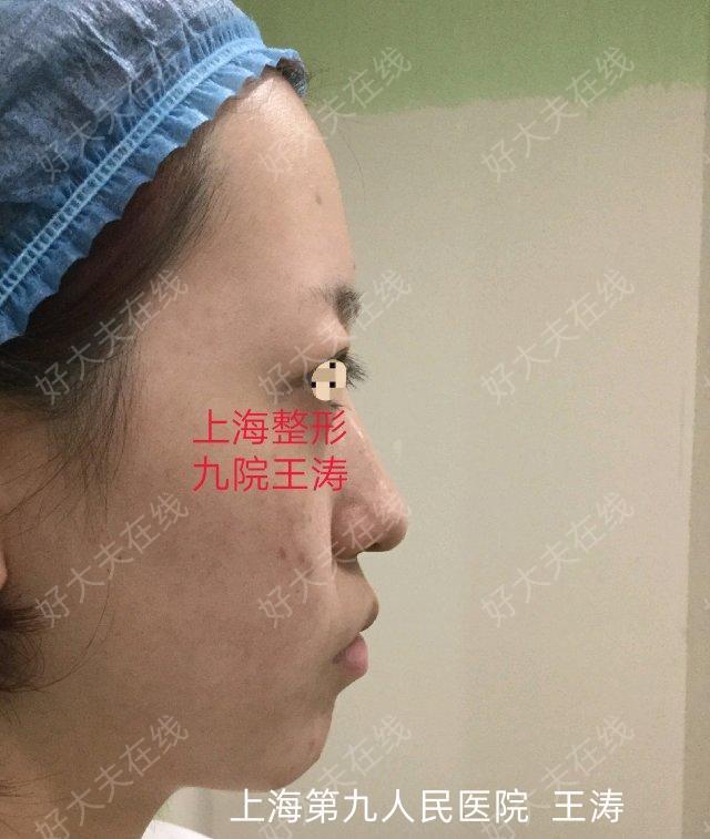 圖文圖片
