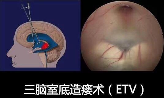 圖文圖片