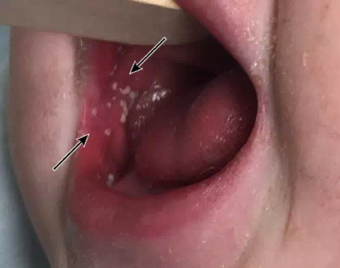 圖文圖片