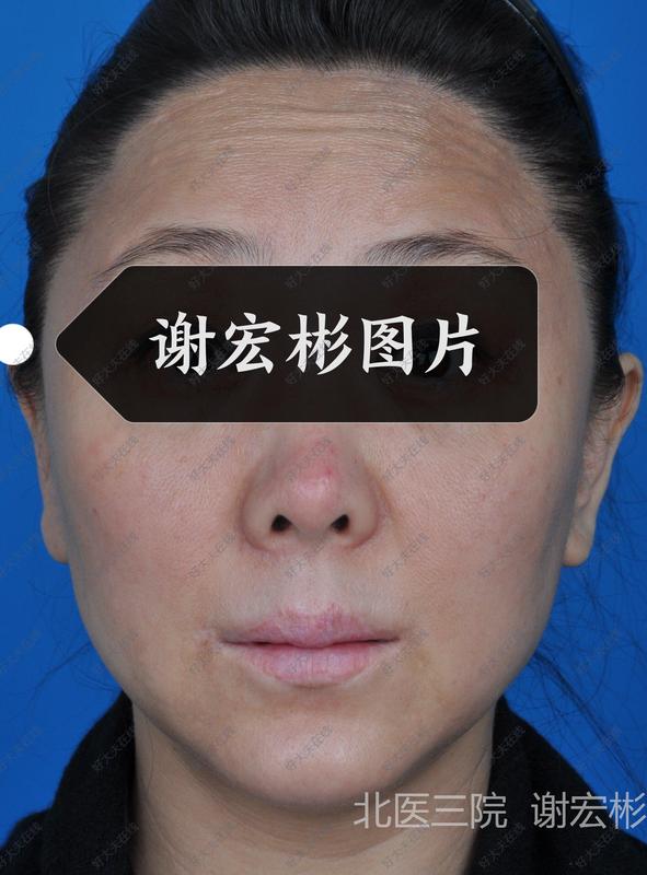 圖文圖片