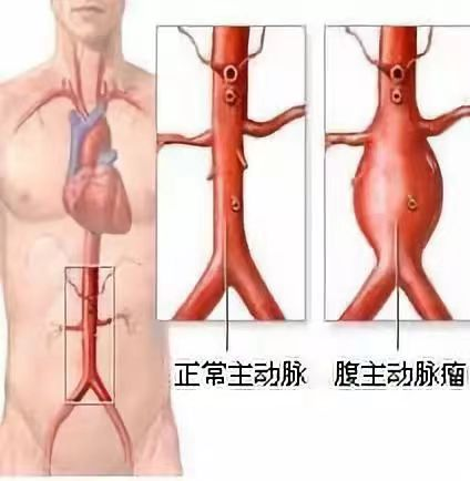 圖文圖片