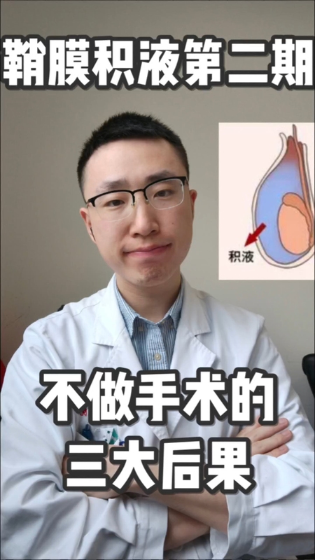 鞘膜积液不手术的三大后果