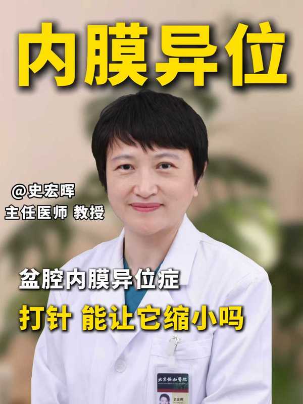 盆腔子宫内膜异位症，打针能让它缩小吗？