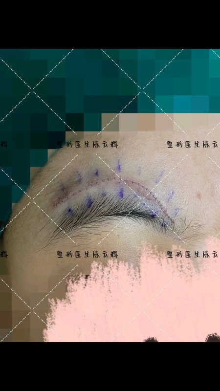 視頻封面