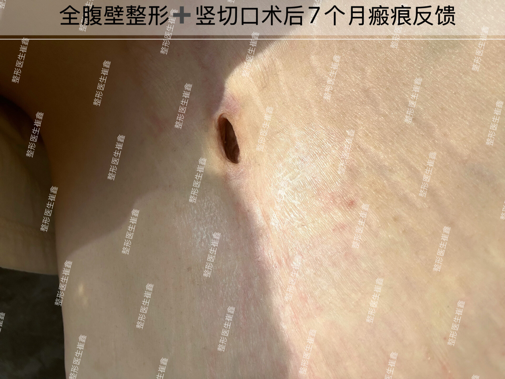 图文图片