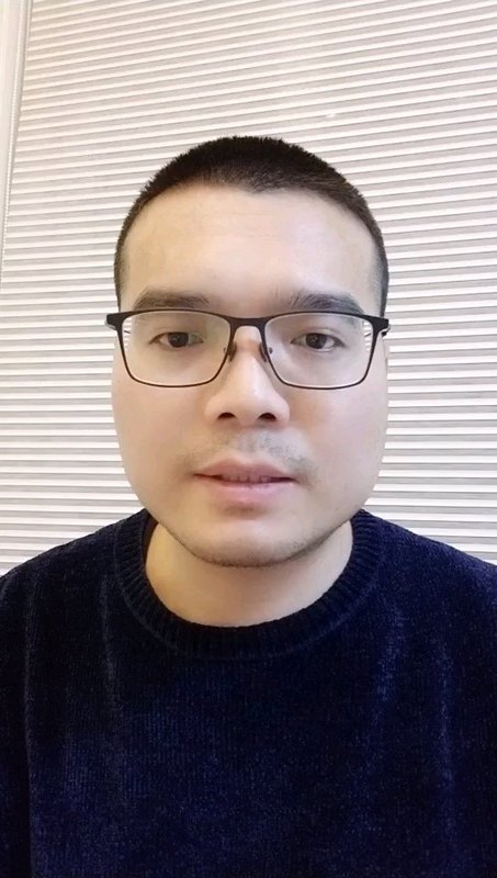 进行性肌营养不良症遗传吗