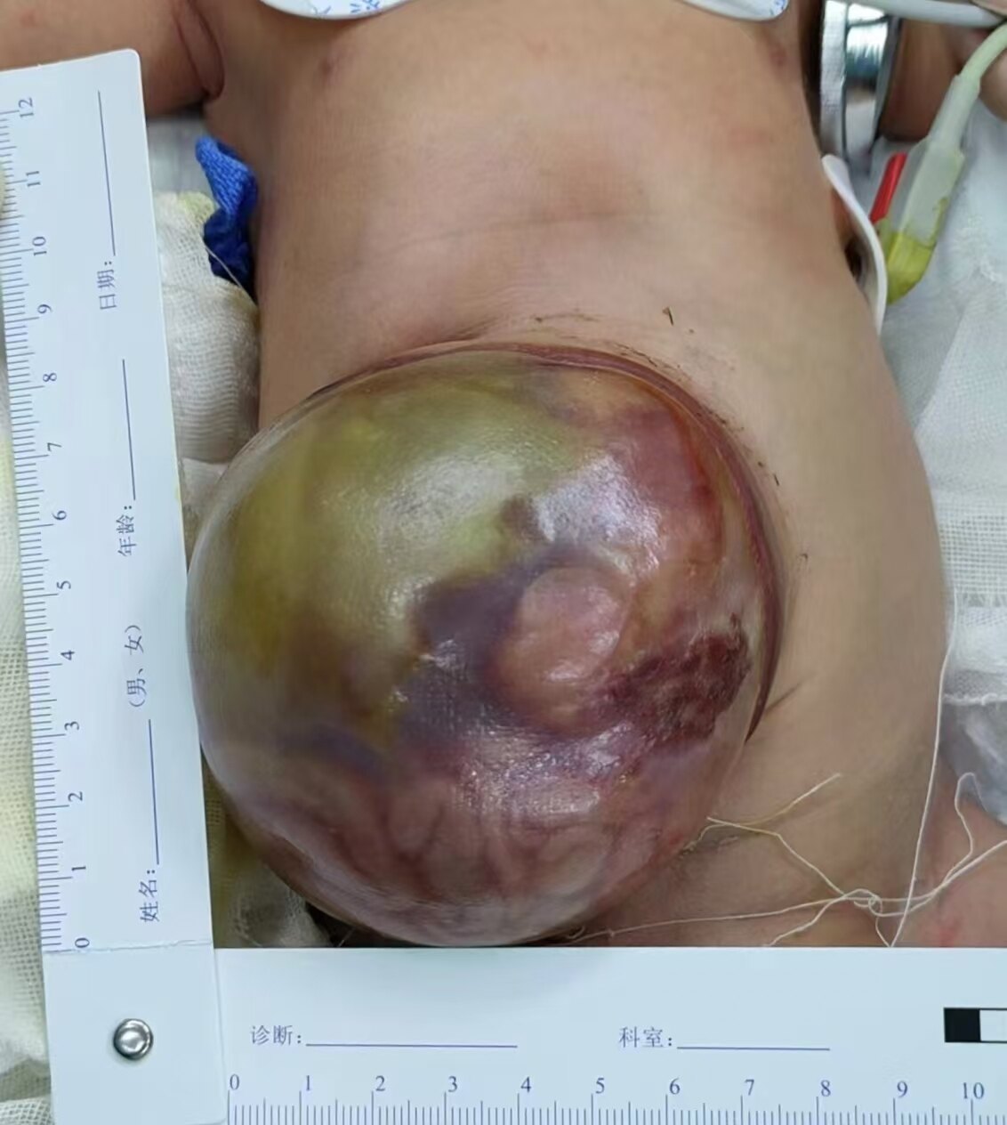 圖文圖片