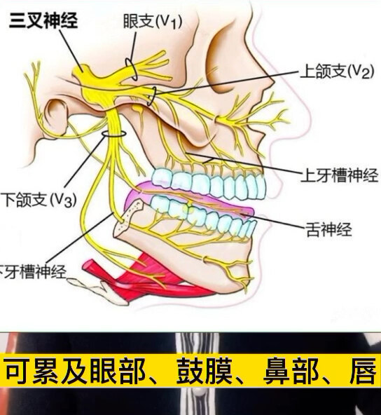 什么是太田痣？
