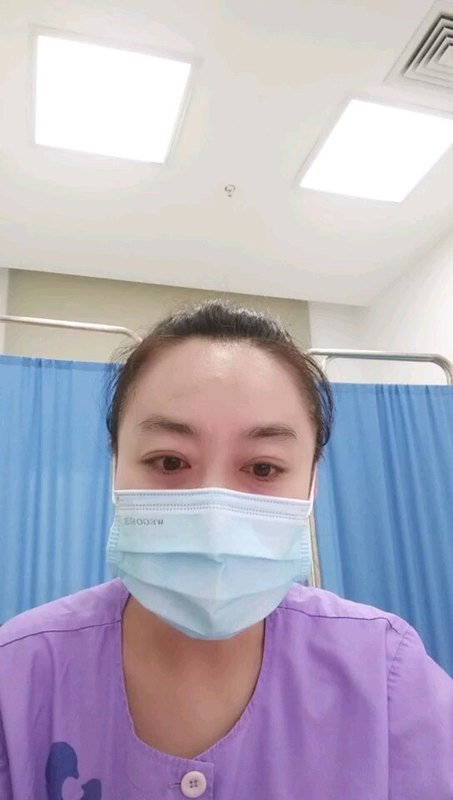 牛奶蛋白过敏有哪些危害