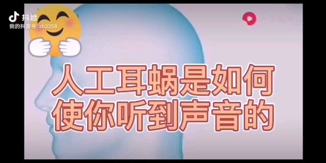 人工耳蜗到底有多神奇！