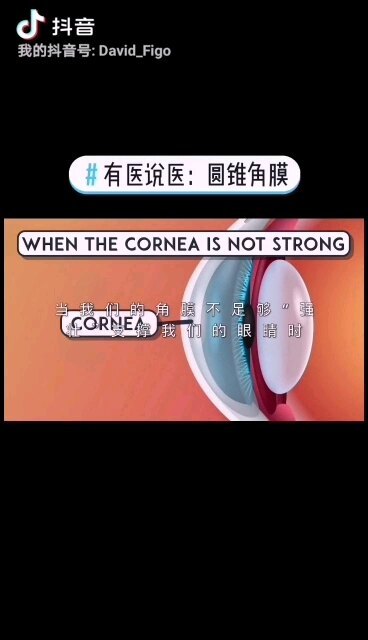 有医说医：圆锥角膜 ＃眼健康科普短视频