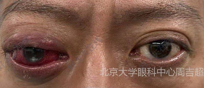 圖文圖片
