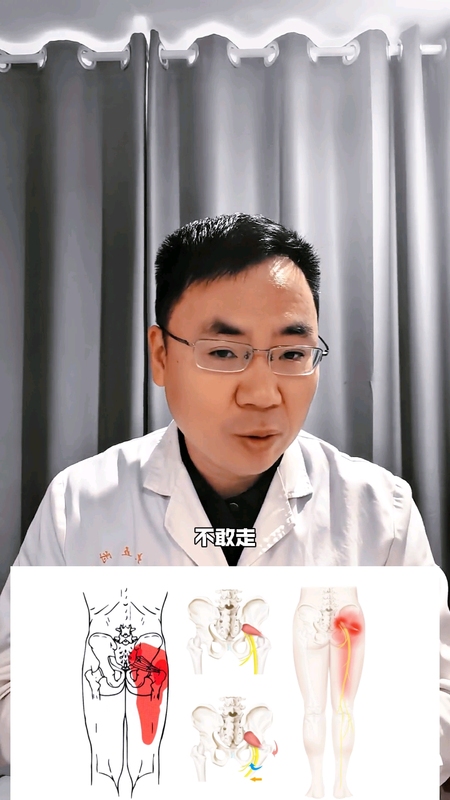 梨状肌综合征不要怕？如何加速恢复和预防？
