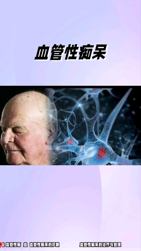 血管性痴呆