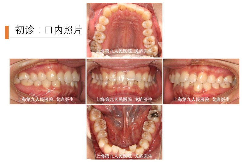 圖文圖片