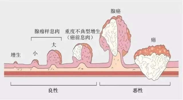 圖文圖片