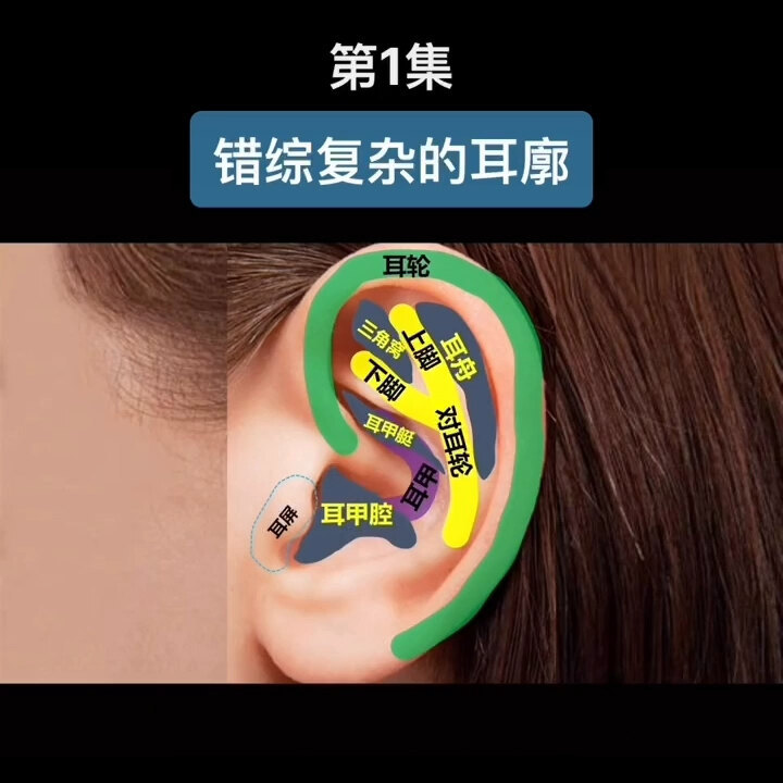 新生儿耳廓畸形矫正（1）
                    错综复杂的耳廓外形