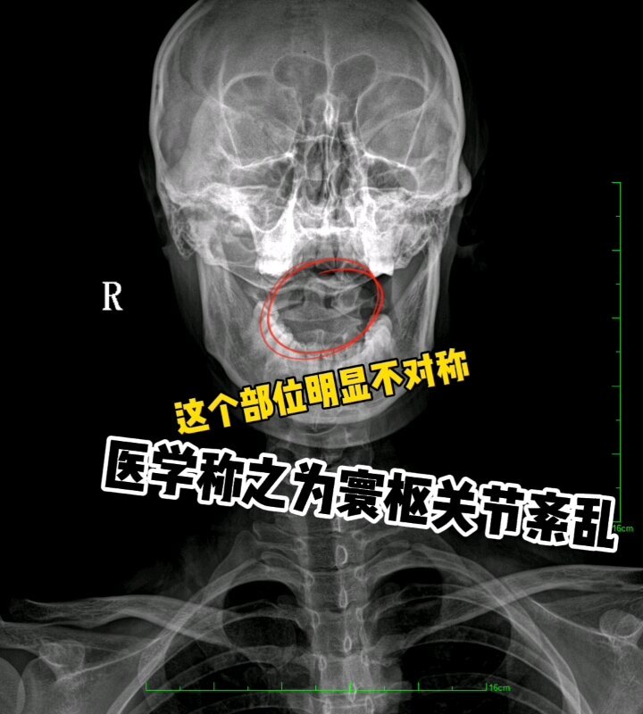 視頻封面