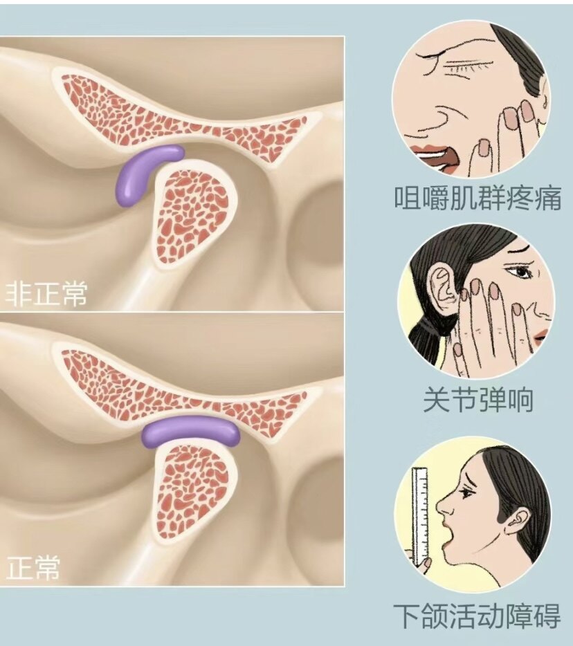 圖文圖片