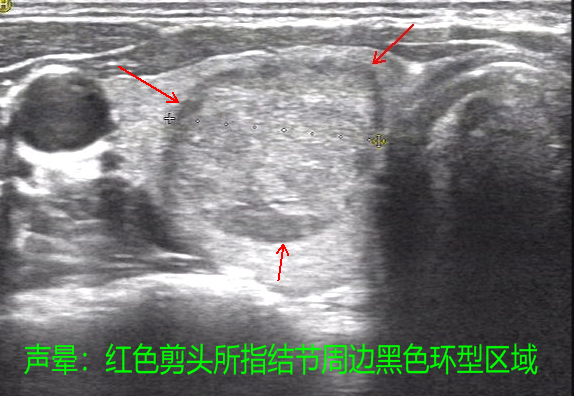 圖文圖片