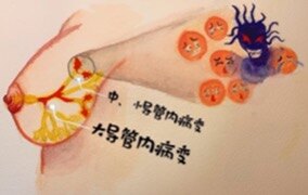 圖文圖片