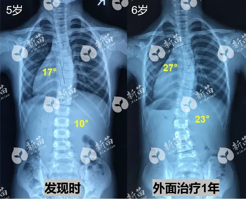 圖文圖片