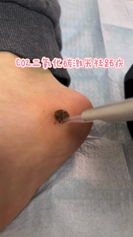 視頻封面