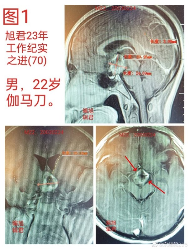 圖文圖片
