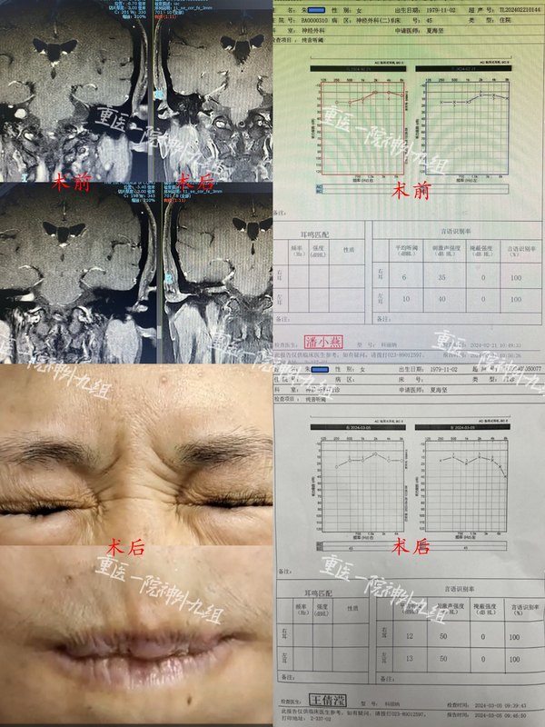 圖文圖片