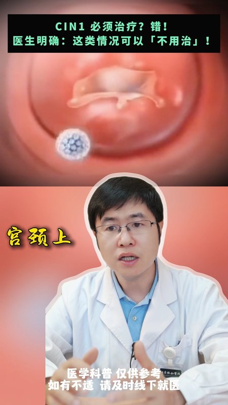 CIN1 必须治疗？错！医生明确：这类情况可以「不用治」！