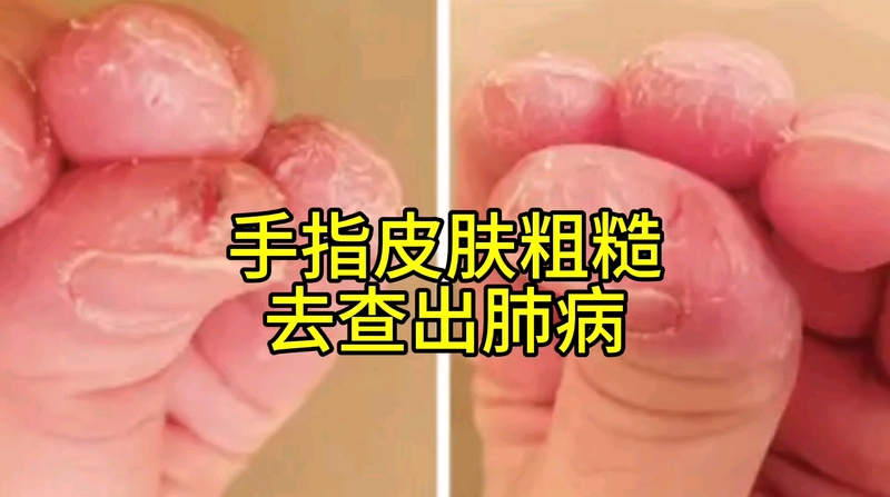 視頻封面