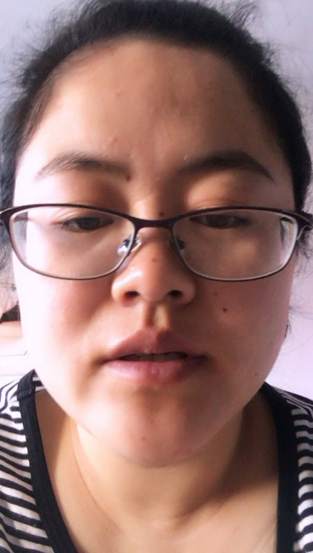 小儿肾病的表现