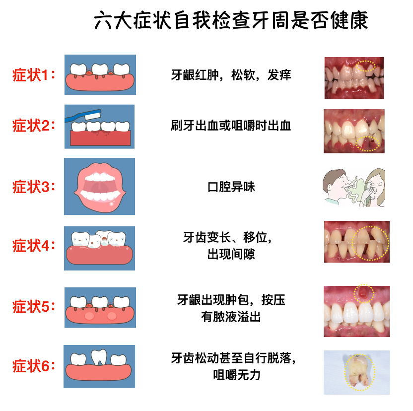 圖文圖片