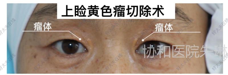 圖文圖片